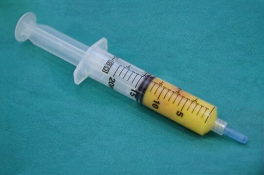 Adipose tissue syringe for liposuction