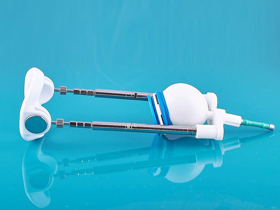 The extension will help to improve the result of the ligamentotomy