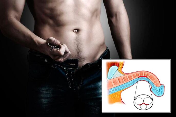 Man disconnects his fly for penis enlargement exercises